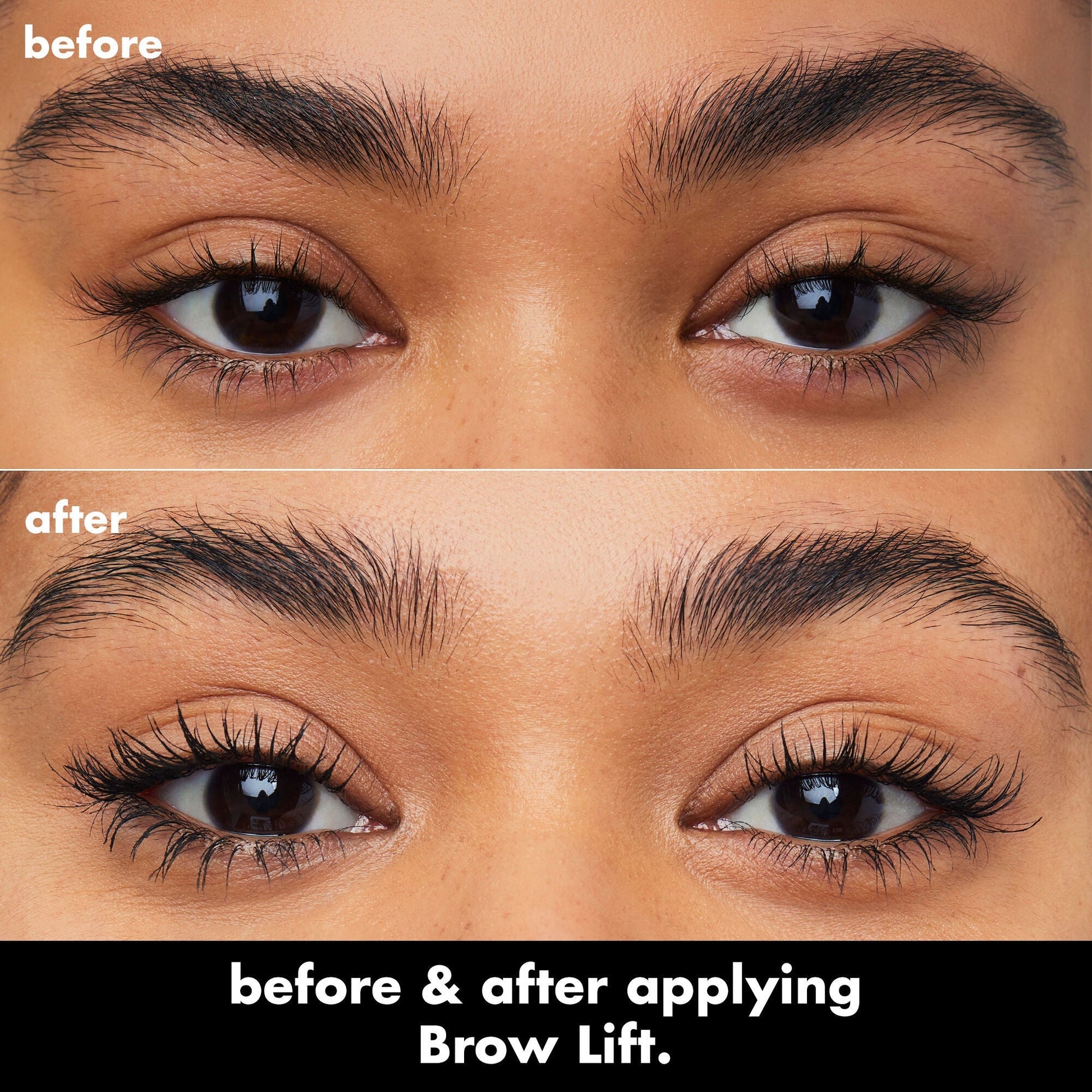 brow-lift-z0 0326_EDU_BrowLift_BA.jpg