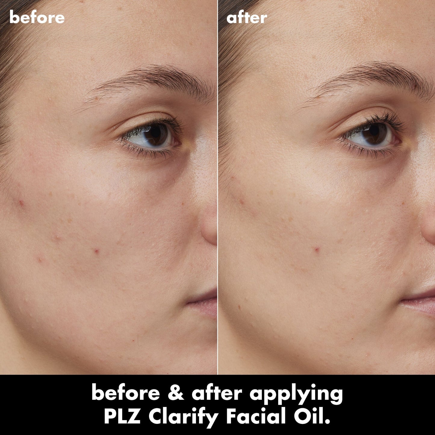 plz-clarify-facial-oil-s9 0326_EDU_PlzClarify_BA_Kelly.jpg