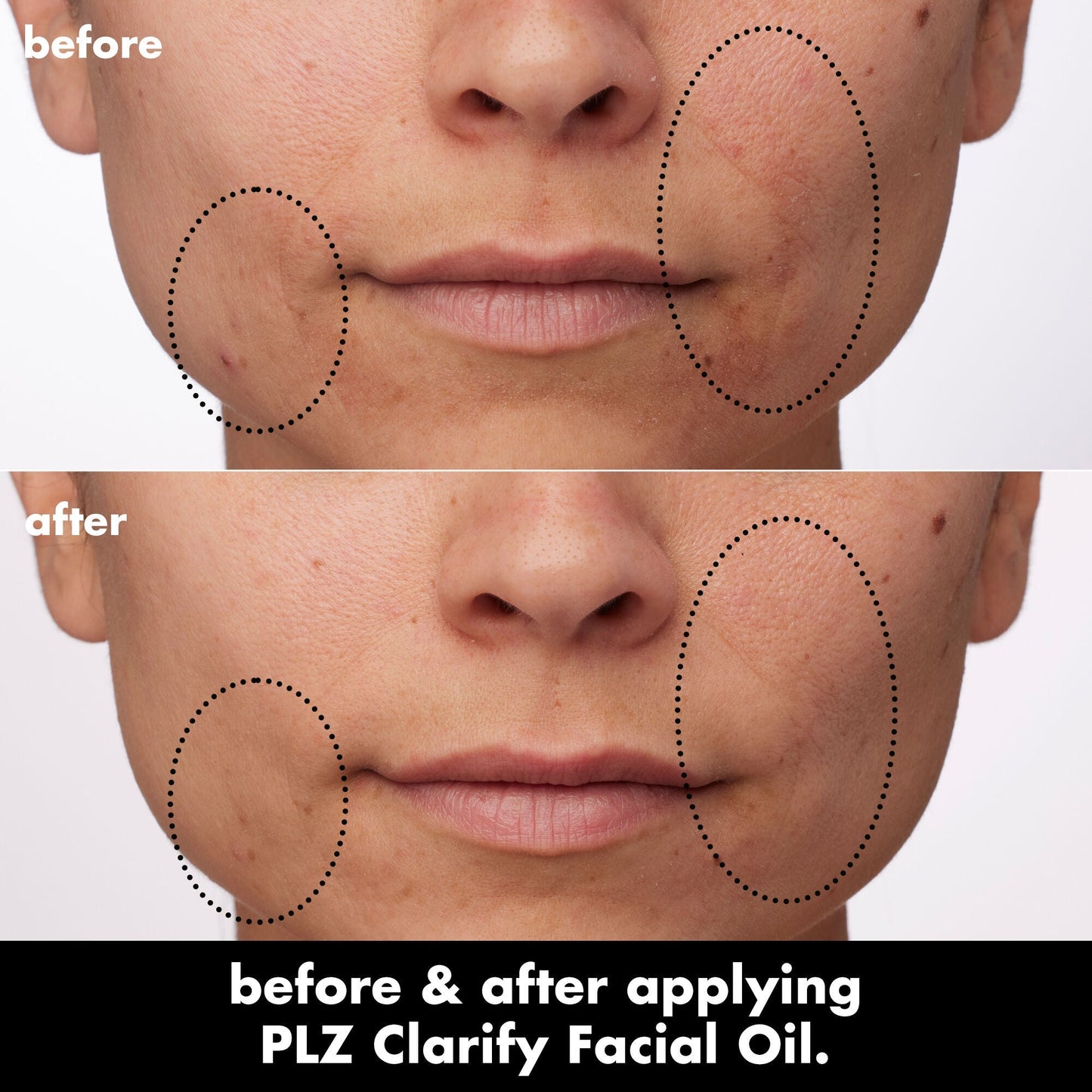plz-clarify-facial-oil-s9 0326_EDU_PlzClarify_BA_Paula.jpg